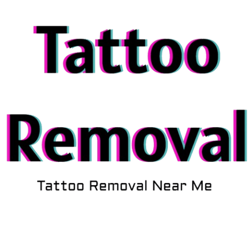 Tattoo removal near me finder