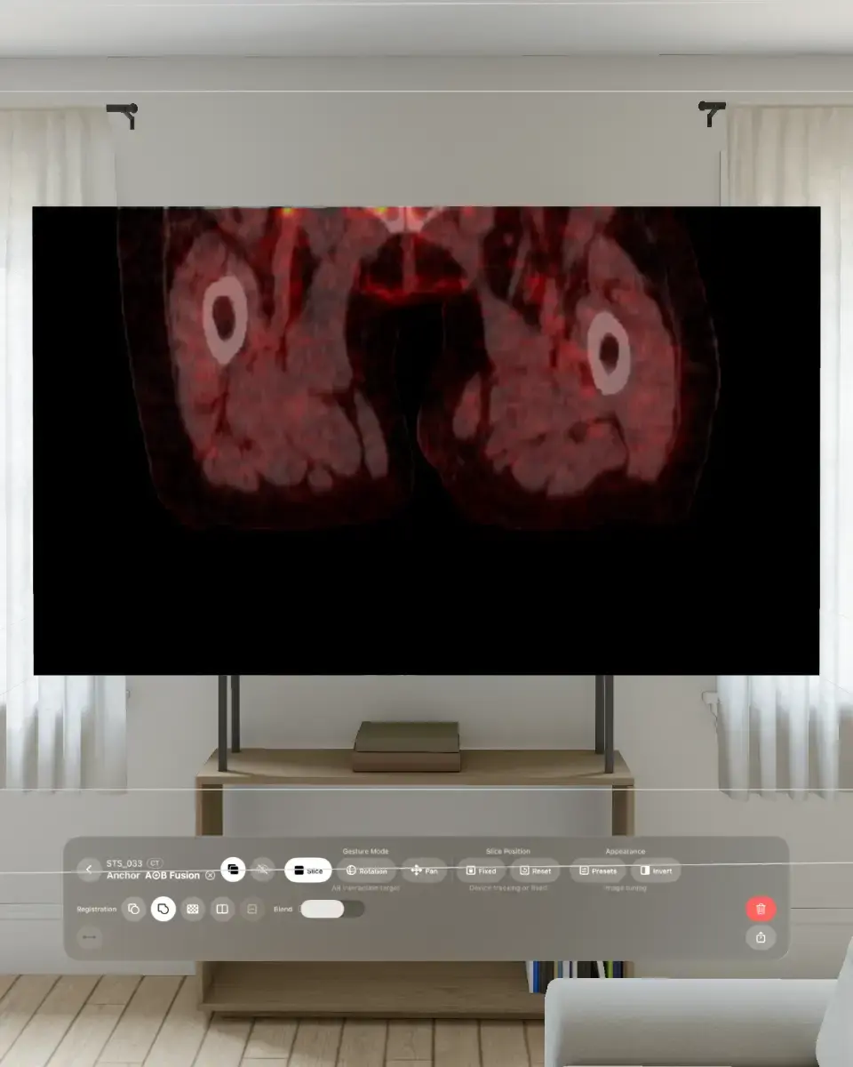 VoxelVision AR Medical Imaging screenshot 2