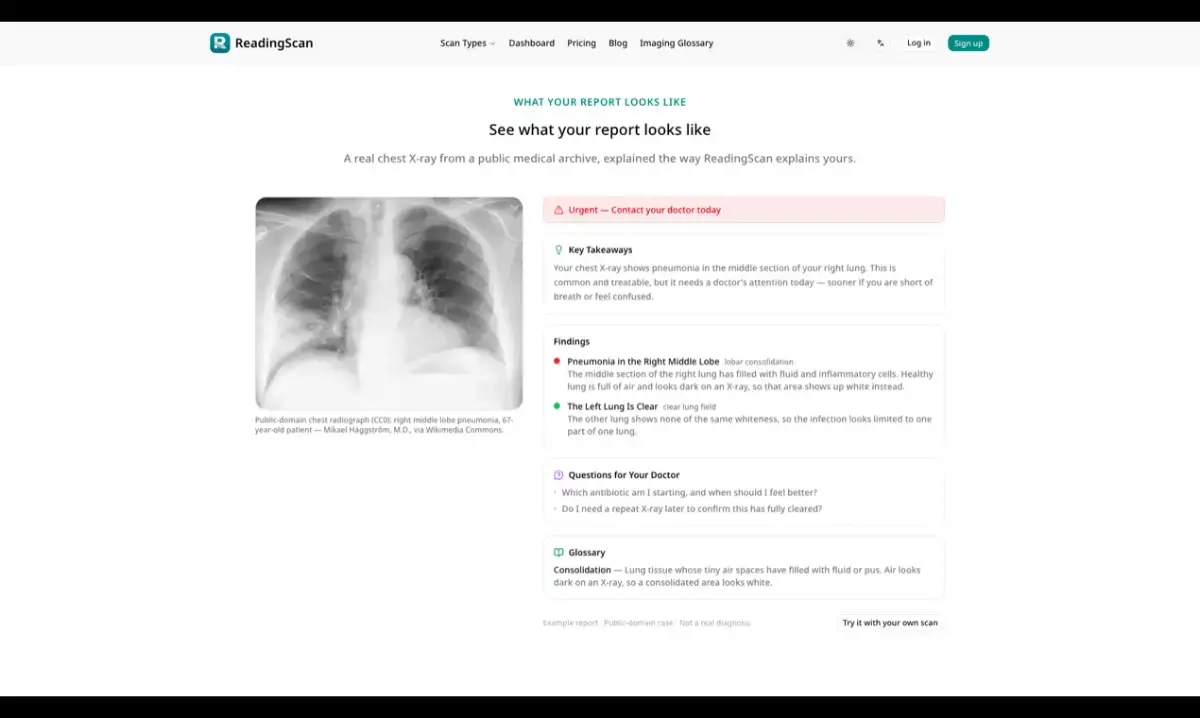 ReadingScan screenshot 3