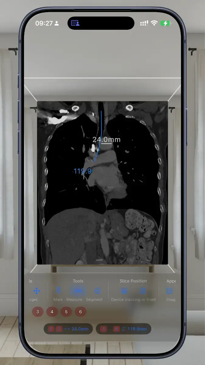 VoxelVision AR Medical Imaging screenshot 1